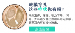 鼓膜穿孔的症状是什么