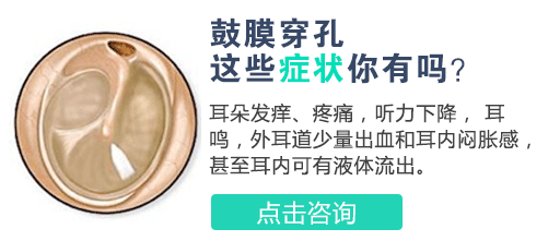 鼓膜穿孔的症状