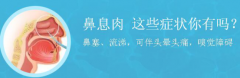 鼻息肉的症状有哪些