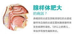 什么原因导致腺样体肥大