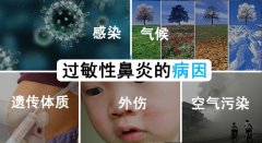 医生解答导致过敏性鼻炎原因