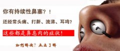 鼻息肉鼻甲肥大怎么办