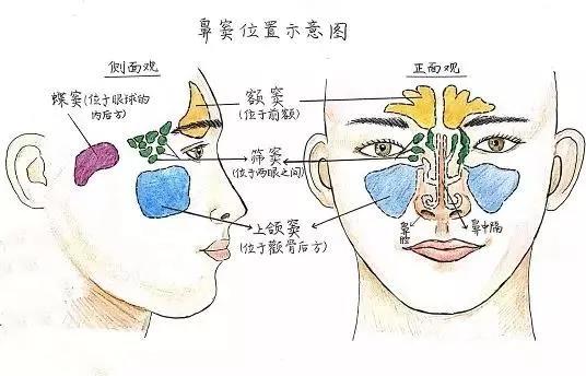 切除腺样体还能治鼻窦炎,这是什么操作?